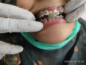 Orthodontic.