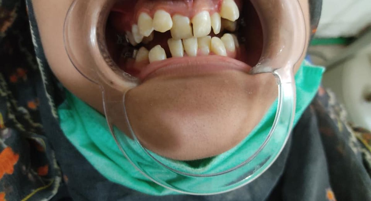 Orthodontic-1