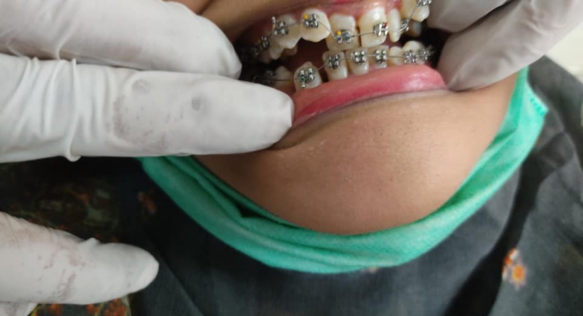 Orthodontic.